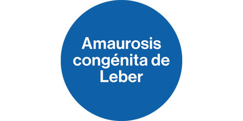 amaurosis