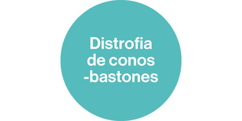distrofia de conos