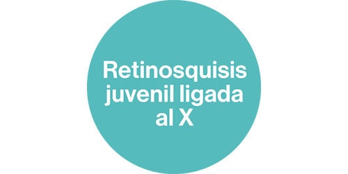 retinosquisis