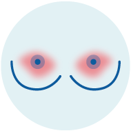 icono 10 cancer de mama sintomas